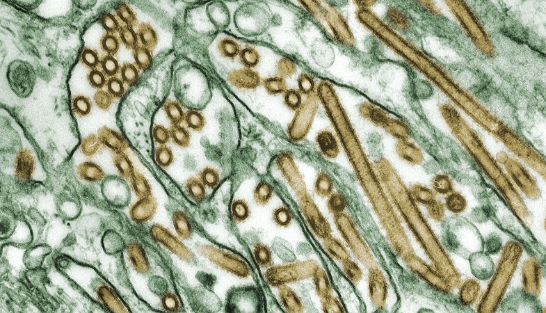 Eleven Fatalities Due to Legionella Outbreak in Poland
